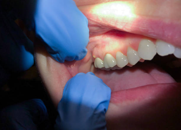 Best Emergency Cosmetic Dentistry in Squirrel Mountain Valley, CA